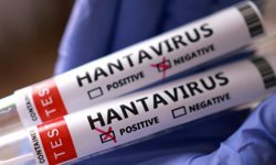 Sağlık Bakanlığı'ndan "hantavirüs" açıklaması
